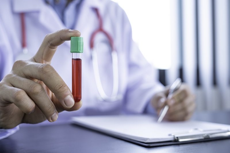 PCR para detección de VPH (28 genotipos) en Miguel Hidalgo