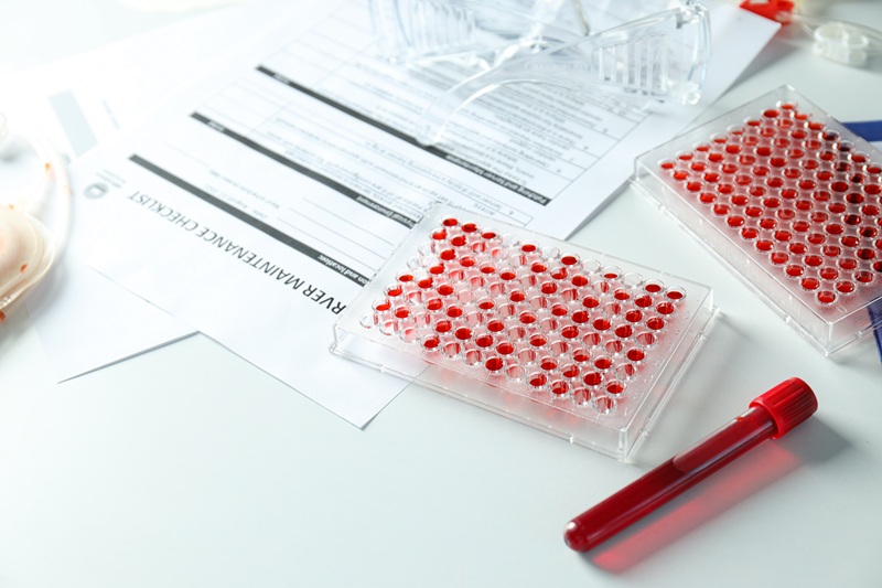 PCR para enfermedades de transmisión sexual en Miguel Hidalgo